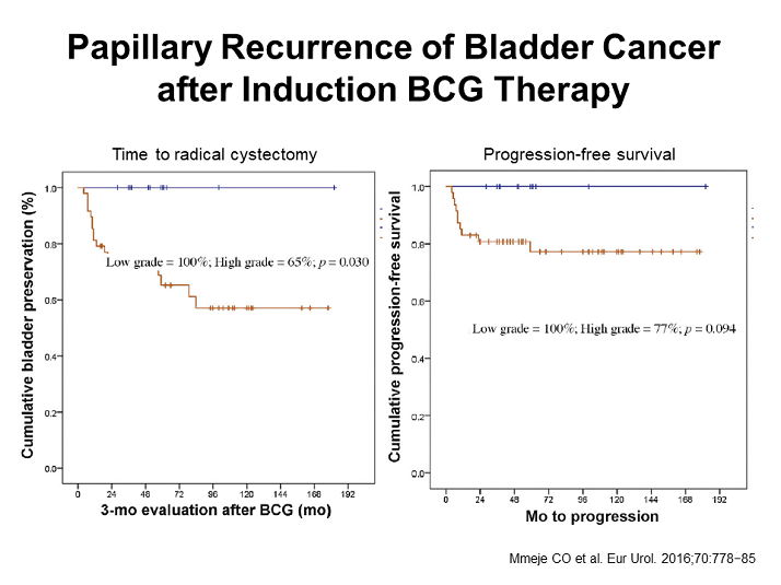 Papillary Recurrence Of Bladder Cancer After Induction Bcg Therapy